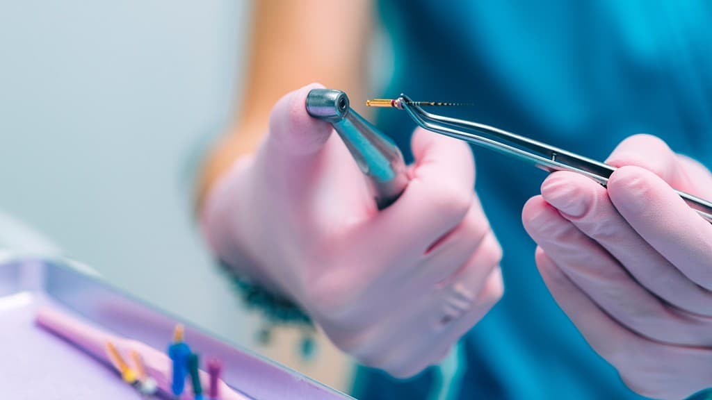 Cuanto cuesta una endodoncia en Lugo