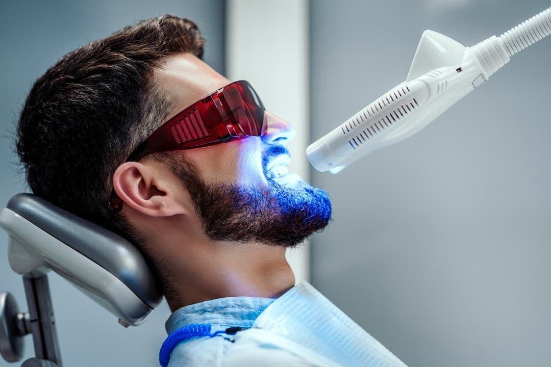 Carillas esteticas dentales en Lugo
