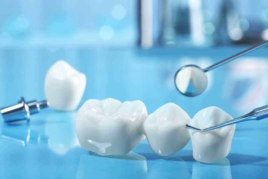 Tratamientos de estetica dental en Lugo