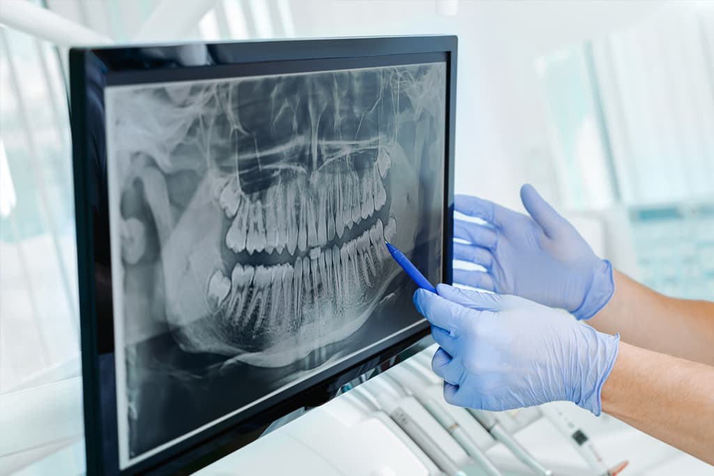 Clínica de implantología oral en Lugo