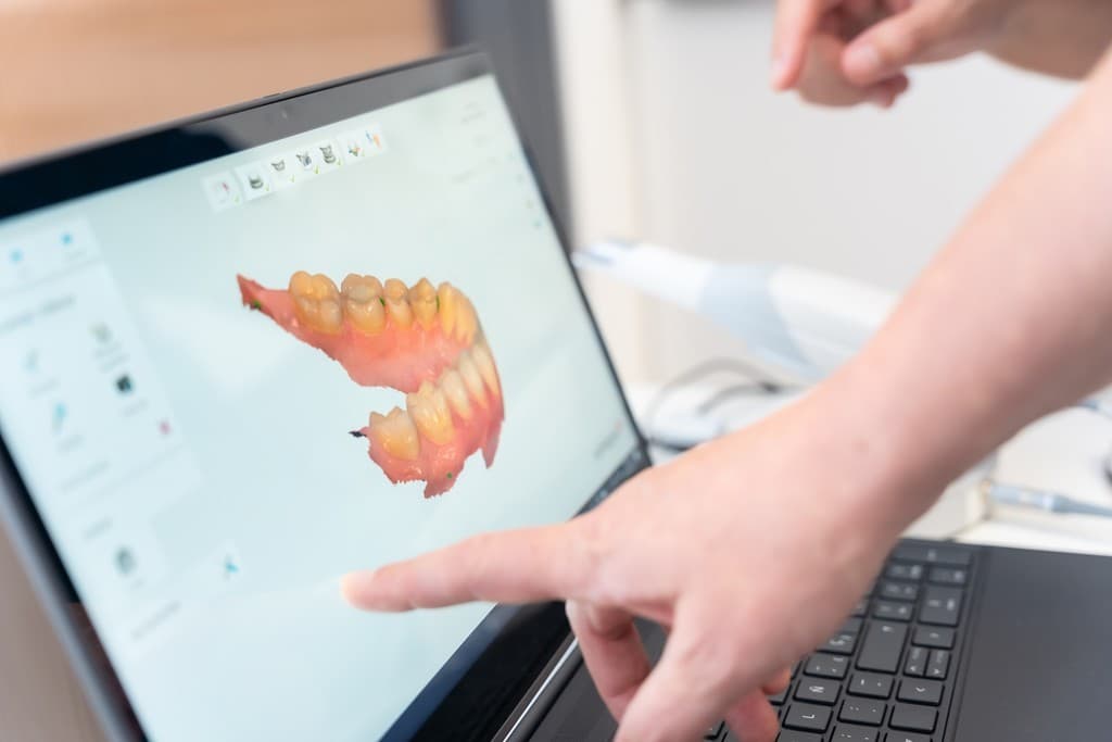 Implantología dental en Lugo