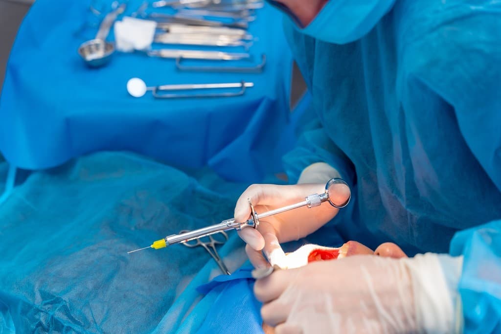 Implantólogo oral en Lugo