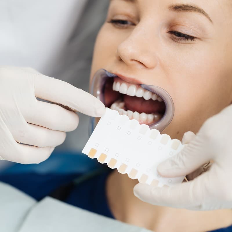 Estetica dental en Lugo